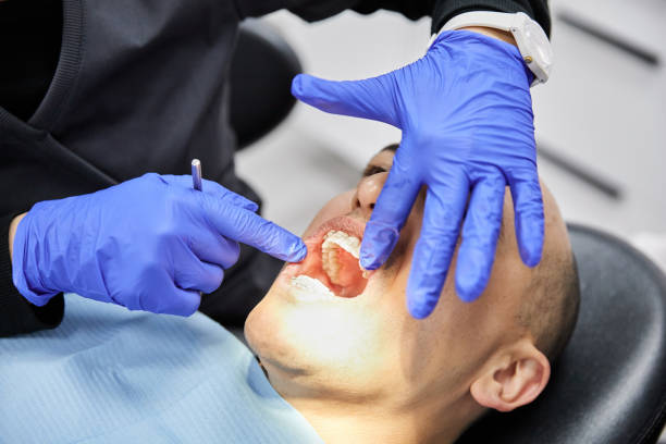 Best Emergency Tooth Extraction in Auburn, MI